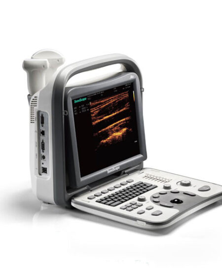 Portable Diagnostic Ultrasound System Sonoscape A6